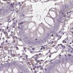 ISYNA1 Antibody in Immunohistochemistry (IHC)