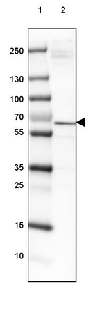 ISYNA1 Antibody in Western Blot (WB)