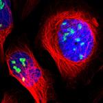 ZSCAN1 Polyclonal Antibody