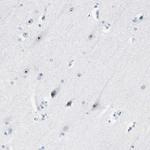 ZSCAN1 Antibody in Immunohistochemistry (Paraffin) (IHC (P))