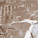 XYLT1 Polyclonal Antibody