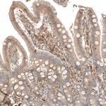 VISTA Polyclonal Antibody