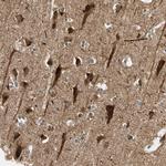 FGD6 Antibody in Immunohistochemistry (Paraffin) (IHC (P))