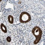 FGD6 Antibody in Immunohistochemistry (Paraffin) (IHC (P))