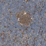 FGD6 Antibody in Immunohistochemistry (Paraffin) (IHC (P))