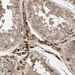 FGD6 Antibody in Immunohistochemistry (Paraffin) (IHC (P))