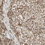 FKBP15 Polyclonal Antibody