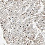 GTF3A Antibody in Immunohistochemistry (IHC)