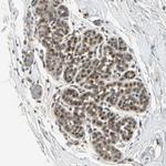 GTF3A Antibody in Immunohistochemistry (IHC)