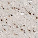 GTF3A Antibody in Immunohistochemistry (IHC)