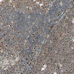 GTF3A Antibody in Immunohistochemistry (IHC)