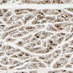 ARHGEF17 Antibody in Immunohistochemistry (Paraffin) (IHC (P))