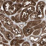 IGFBP6 Polyclonal Antibody