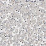 GPD2 Polyclonal Antibody