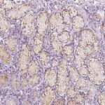 A4GNT Antibody in Immunohistochemistry (Paraffin) (IHC (P))