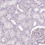 A4GNT Antibody in Immunohistochemistry (Paraffin) (IHC (P))