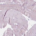 A4GNT Polyclonal Antibody