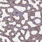 CEL Antibody in Immunohistochemistry (IHC)