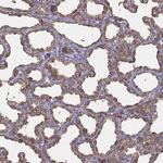 CEL Antibody in Immunohistochemistry (IHC)