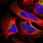 SFXN3 Polyclonal Antibody