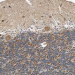 SFXN3 Antibody in Immunohistochemistry (Paraffin) (IHC (P))