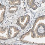 SFXN3 Antibody in Immunohistochemistry (Paraffin) (IHC (P))