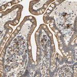 SFXN3 Antibody in Immunohistochemistry (Paraffin) (IHC (P))