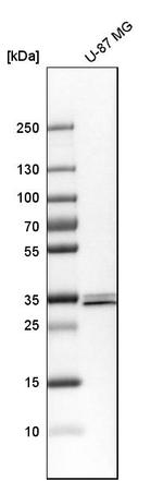SFXN3 Antibody in Western Blot (WB)