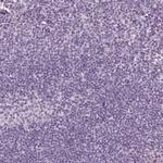 SLC6A17 Polyclonal Antibody