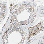 LY6G6F Polyclonal Antibody