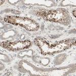 CALCRL Polyclonal Antibody