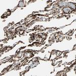 CALCRL Antibody in Immunohistochemistry (Paraffin) (IHC (P))