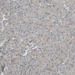 CALCRL Antibody in Immunohistochemistry (Paraffin) (IHC (P))