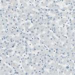 RNF43 Antibody in Immunohistochemistry (IHC)