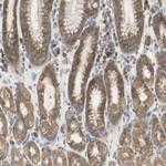 TTMP Polyclonal Antibody