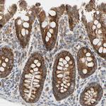 TBC1D10A Antibody in Immunohistochemistry (Paraffin) (IHC (P))