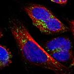 ATP6V1B2 Polyclonal Antibody