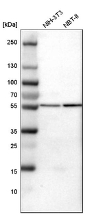 ATP6V1B2 Antibody in Western Blot (WB)