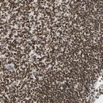 LAP2 Antibody in Immunohistochemistry (IHC)