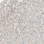 TRIO Antibody in Immunohistochemistry (IHC)