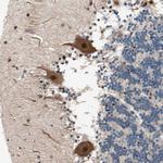 NGEF Antibody in Immunohistochemistry (Paraffin) (IHC (P))