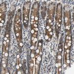 NGEF Antibody in Immunohistochemistry (Paraffin) (IHC (P))