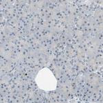 NGEF Antibody in Immunohistochemistry (Paraffin) (IHC (P))