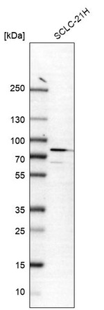 CRTAC1 Antibody in Western Blot (WB)