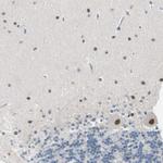 PSMA2 Antibody in Immunohistochemistry (Paraffin) (IHC (P))