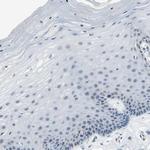 PSMA2 Antibody in Immunohistochemistry (Paraffin) (IHC (P))