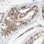 PSMA2 Antibody in Immunohistochemistry (Paraffin) (IHC (P))