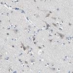 SELK Antibody in Immunohistochemistry (Paraffin) (IHC (P))