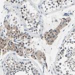 SELK Antibody in Immunohistochemistry (Paraffin) (IHC (P))
