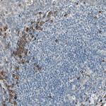 SELK Antibody in Immunohistochemistry (Paraffin) (IHC (P))